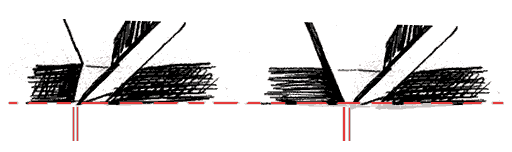 throat opening from redressing